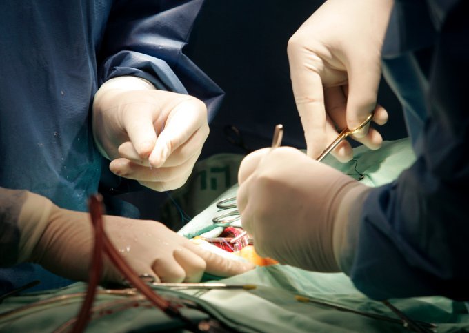 Уникальную операцию по пересадке сердца провели белорусские хирурги